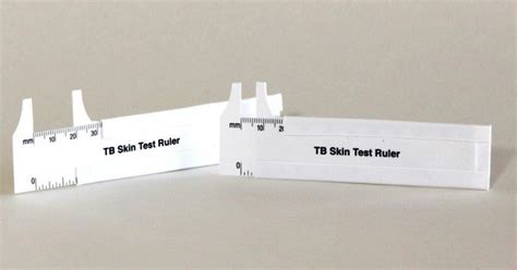 Tuberculosis Skin Test Ruler