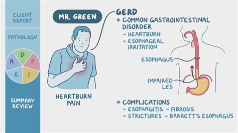 Gastroesophageal Reflux Disease Gerd Nursing Process Adpie