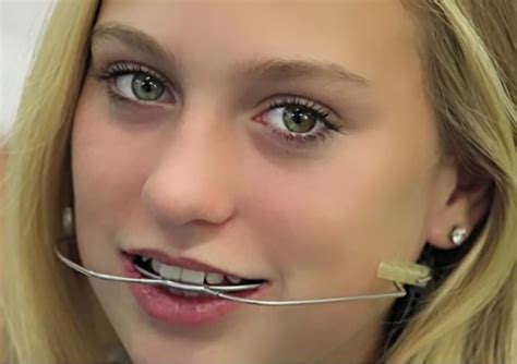 Pin By Larry Greenstein On Girls With Dental Braces And Headgear Dental Braces Braces Girls