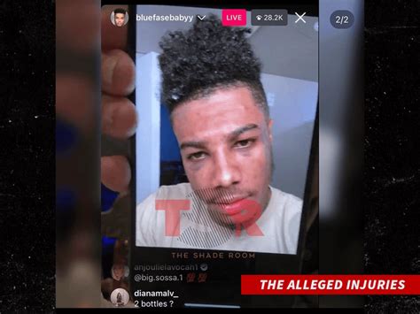 Chrisean Rock Seems To Admit To Giving Blueface Two Black Eyes