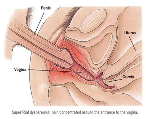 Cervix During Sex Xxgasm