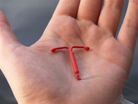 Questions About Iuds You Were Too Embarrassed To Ask