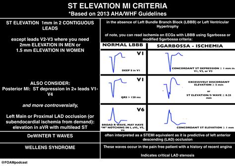 ST Elevation MI Criteria Diagnosis Cardiology ECG GrepMed