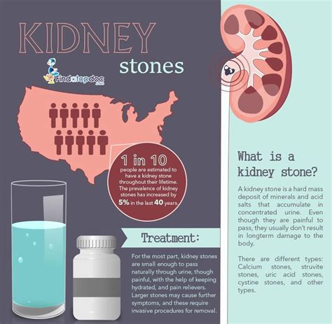 Kidney Stones Symptoms Causes Treatment And Diagnosis Findatopdoc