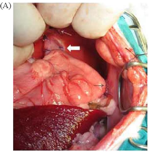 A First Surgery Intraoperative Image Of A Kitten With Type I Hiatal