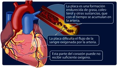 Guía Para Pacientes Que Están En Tratamiento De Una Cardiopatía