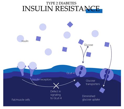 Insulin Resistance Condition In Type 2 Diabetes Symptoms Risks And