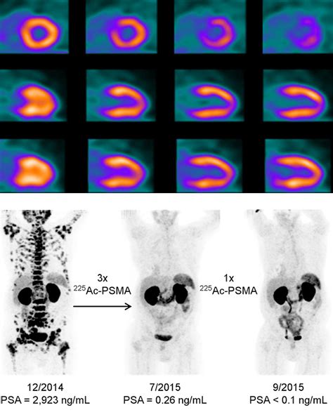 Willard libby developed radiocarbon dating as a method to measure radioactivity. Producing Radioisotopes for Medical Imaging and Disease ...
