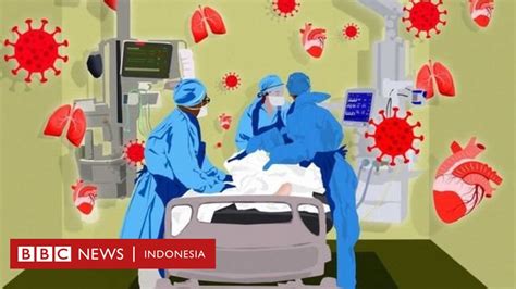 Virus Corona Perkembangan Dari Penyakit Pernapasan Ke Serangan