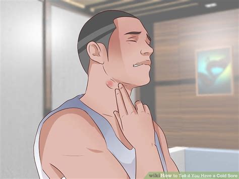 How To Tell If You Have A Cold Sore With Pictures Wikihow