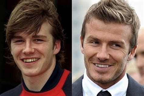 David Beckham Chirurgie Dentaire David A Lun Des Plus Beaux Sourire