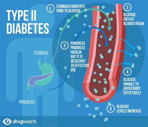 Diabetes Symptoms Diagnosis Treatments And Complications