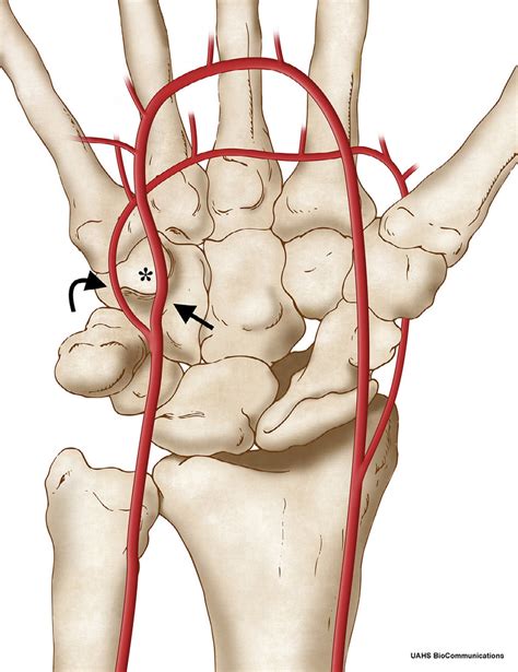 Artist Drawing Of The Superficial And Deep Ulnar Artery Along Guyons