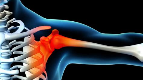 Physical Therapy Can Reduce Your Shoulder Pain Reddy Care Physical