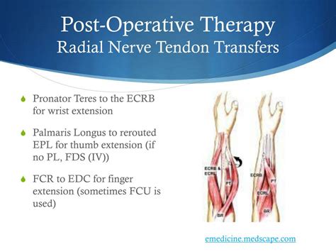 Ppt Therapy Considerations For The Radial Nerve Powerpoint