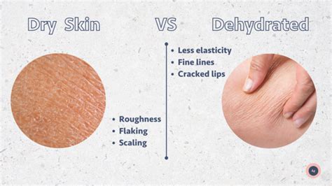 Dry Skin Vs Dehydrated Skin Whats The Difference Mbman