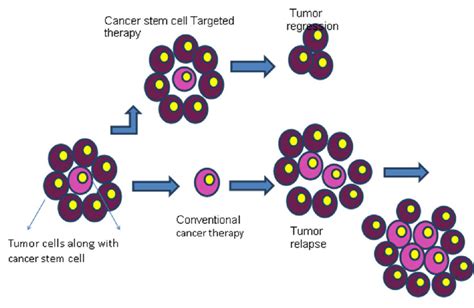 Treatment Of Cancer Progression By Conventional And Cancer Stem Cell