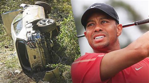 Tiger Woods Recovering After Car Crash Surgery Will He Ever Golf Again