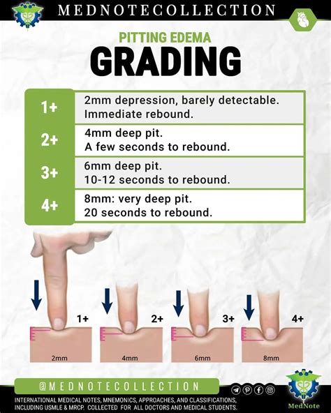 Mednote Collection — 🧠 Grading Of Pitting Edema Mednote Collection