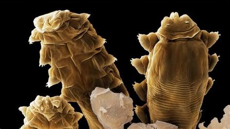 These Microscopic Mites Live On Your Face Demodex Face Micro