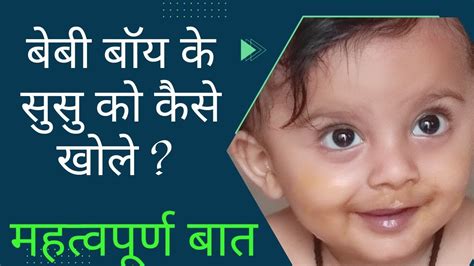 बेबी बॉय का सुसु कैसे खोले । How To Open Private Part Of Baby Boy