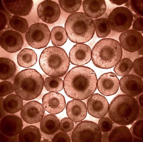 Afbeeldingsresultaat Voor Microscopic Human Skin Cells Body Cells Skin