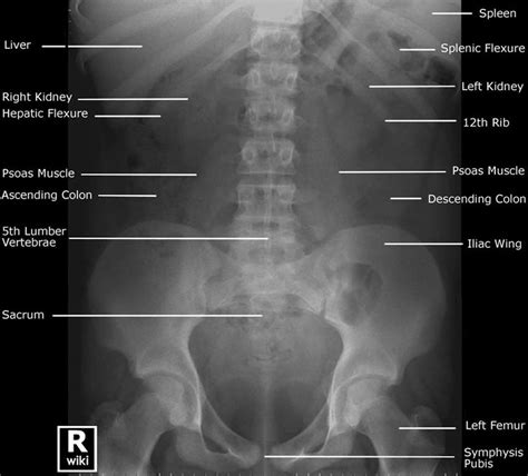 Radiology Anatomy And Medical Imaging