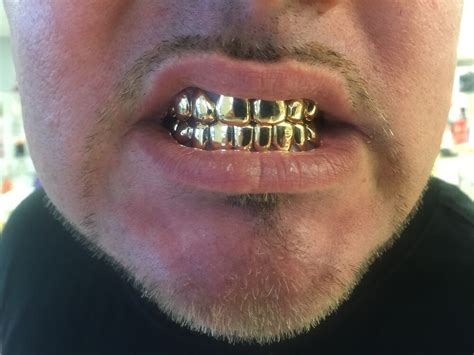 Locks in upto 4 months) **permanent cement upon request (professional use only: Gold Grills 10k 8 Top & 8Bottom Solid With Deep Cut/Permanent Looking Custom Fit | eBay