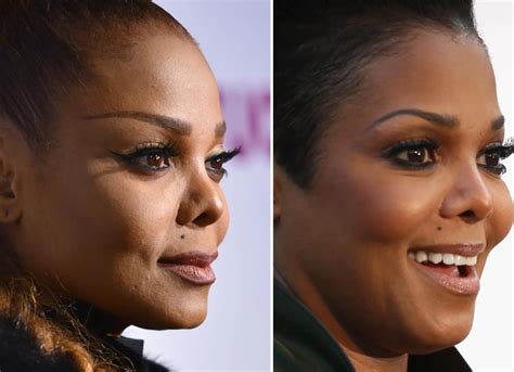 Janet Jacksons Plastic Surgery Her Several Cosmetic Procedures