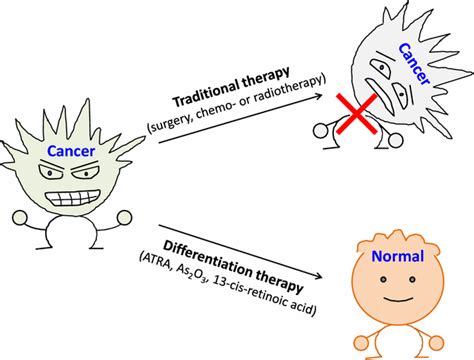 Differentiation Therapy A Promising Strategy For Cancer Treatment