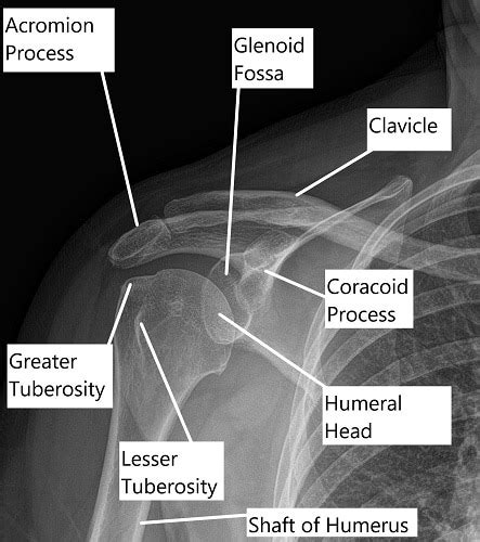 X Ray Shoulder Anatomy
