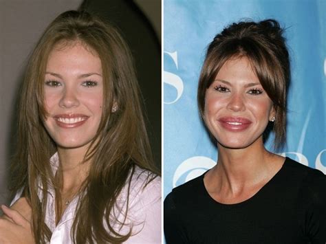 26 Over The Top Hollywood Plastic Surgeries V103 Celebrity Plastic