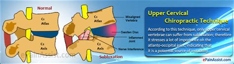 Upper Cervical Chiropractic Techniquestructure Role Of Chiropractor