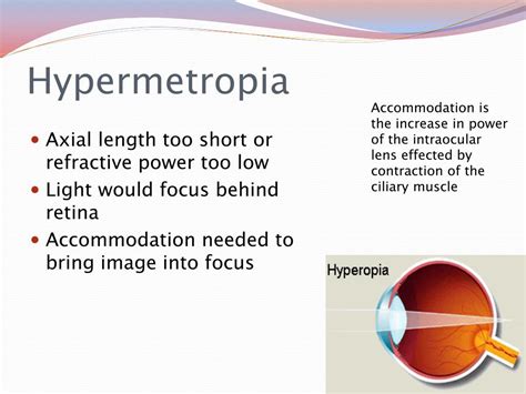 ppt refractive errors refraction and contact lenses powerpoint presentation id 4817600
