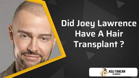 Did Joey Lawrence Have A Hair Transplant Asli Tarcan Clinic