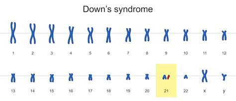 How Rare Is Dna Mosaicism Of The Sex Chromosomes The Tech Interactive