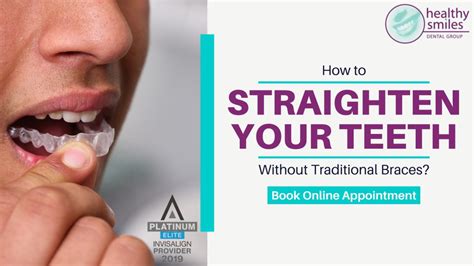 We did not find results for: How to Straighten Teeth Without Braces? Healthy Smiles