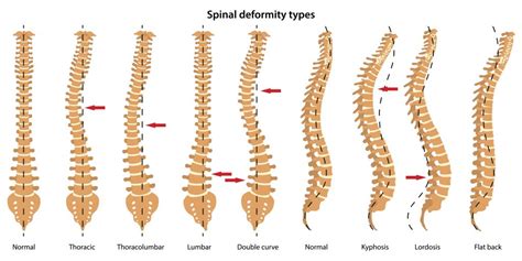 Diagram Of Spine And Neck