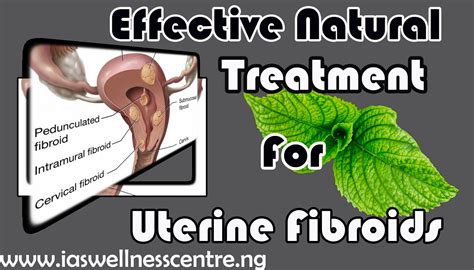 Effective Natural Treatment For Uterine Fibroids I A S Wellness Centre