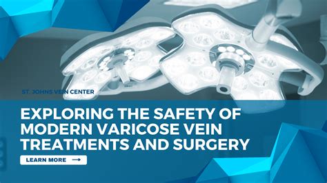 Exploring The Safety Of Modern Varicose Vein Surgery St Johns Vein Center