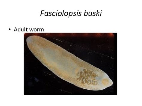 Medical Parasitology Classification Of Parasites Parasites Are Eukaryotes