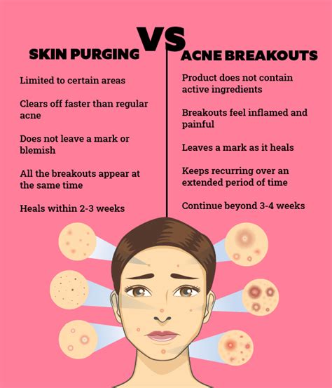 How To Identify And Treat Skin Purging According To A Dermatologist