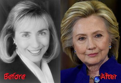 Hillary Clinton Plastic Surgery A Presidential Boost