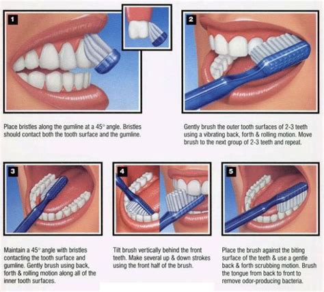 Oral Hygiene Instructions Brushing Toothbrushtoothpaste