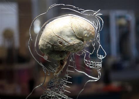 Human Brain In A Jar Found At Canadianmichigan Border