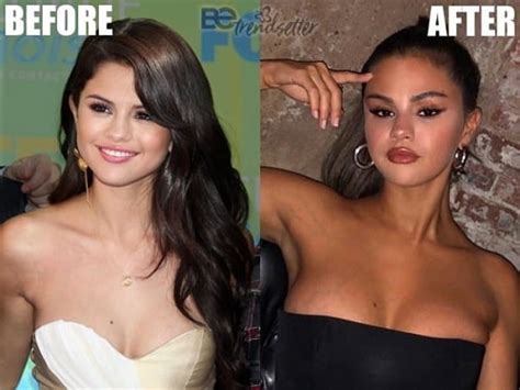 selena gomez all plastic surgery revealed before and after pictures glamour path