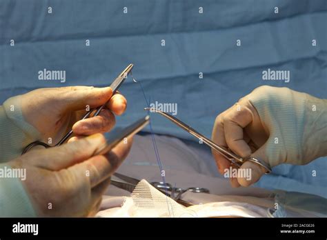 Hernia Operation Surgeons Closing Suturing The Wound Left After