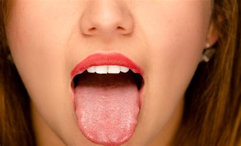 舌苔の取り方はちみつ除去法まとめまだ白い舌で良いの 神様の食材