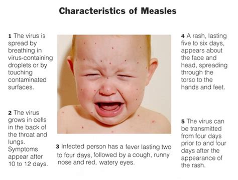 Viral Infections And Children