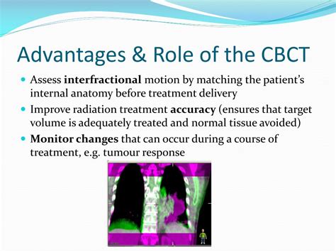 Ppt Introduction To Image Guided Radiation Therapy And Cone Beam